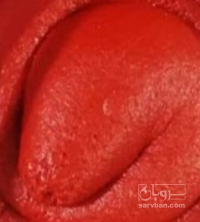 فروش رب گوجه فرنگی